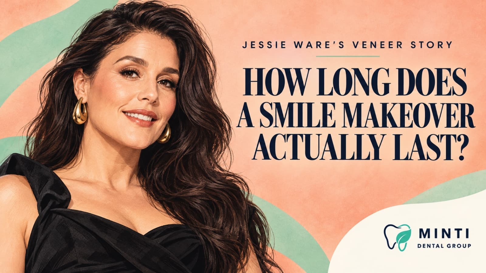 Illustration of Jessie Ware beside the headline “How long does a smile makeover actually last?” with Minti Dental Group branding.