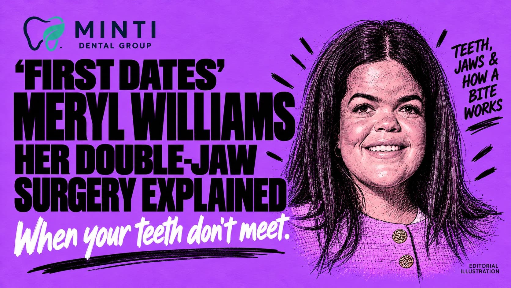 Minti Dental Group graphic on a bold violet background featuring an illustrated portrait of Meryl Williams. Headline reads: “First Dates’ Meryl Williams: Her double-jaw surgery explained”, with the subtitle “When your teeth don’t meet.”